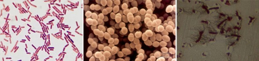 Е. coli, фекални ентерококи и протеи са основните причинители на хроничен бактериален простатит