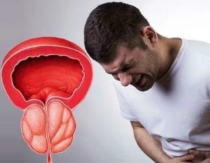 Симптомите на хроничен простатит при мъжете